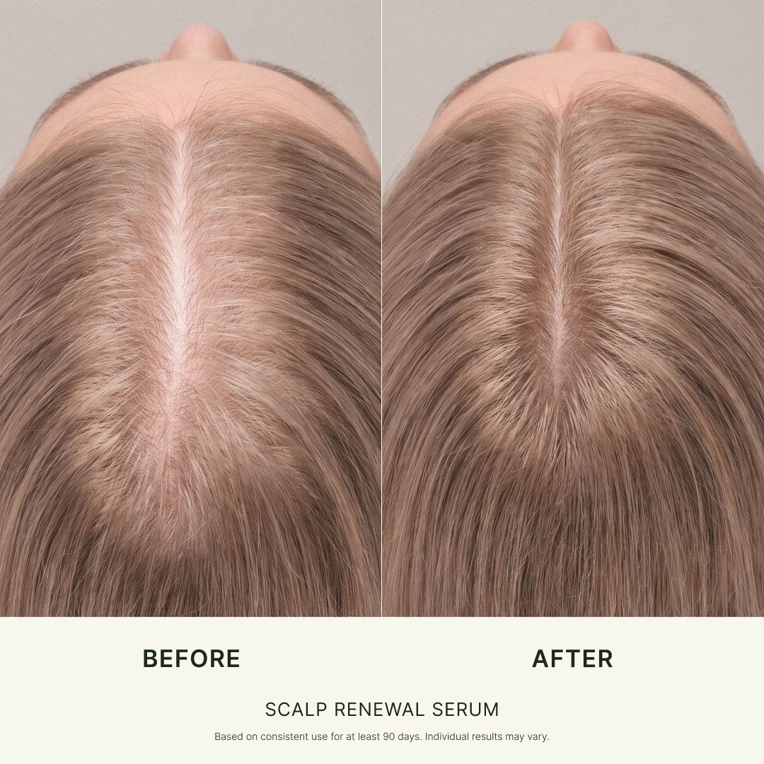 SCALP RENEWAL SERUM